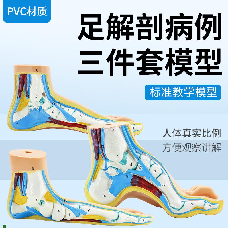 正常足扁平足弓形足模s型/足弓模型解剖模型脚模型教学模型