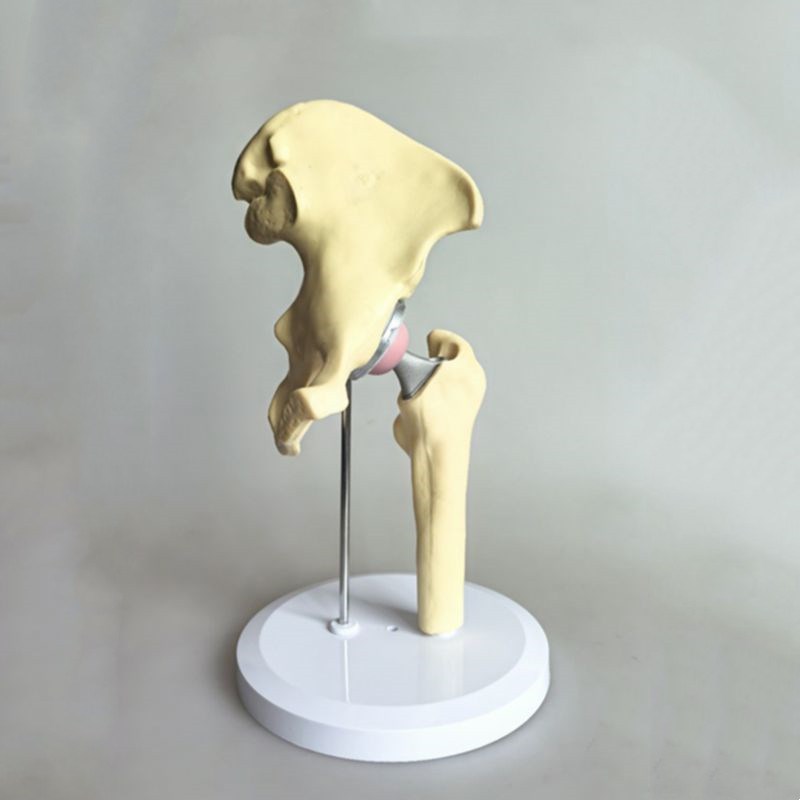 人工髋关节模型假肢替换股骨头置换临床骨科手术教学W术前实操展