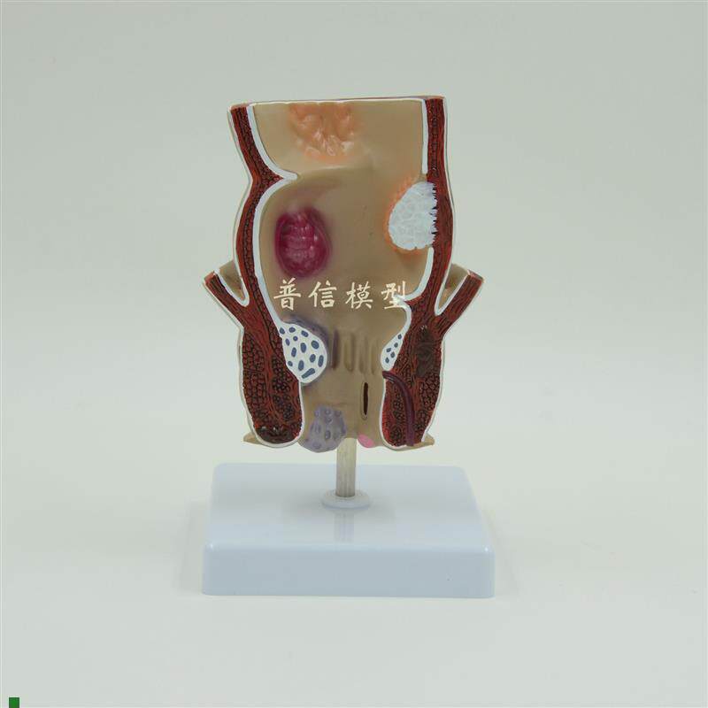 普信仿真人体直j肠结肠演示模型教用医用肛肠科教学沟通用具解剖