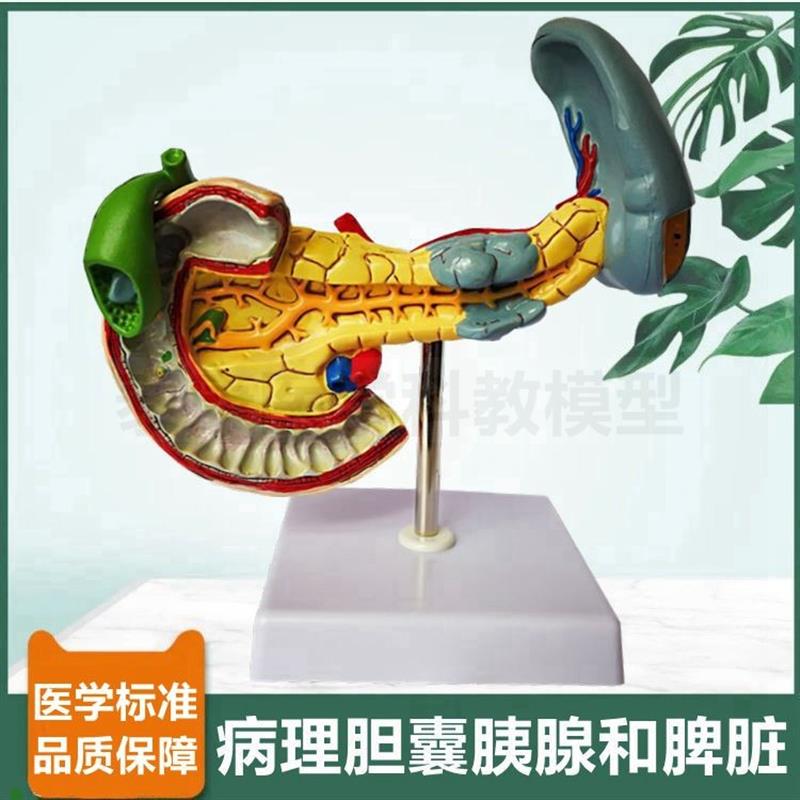 胆囊模型病理胰腺脾脏消化器官十二指肠肝脏O血管肝胆总管临床医