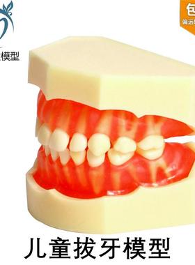 牙科儿童乳牙拔牙模型牙龈牙u齿可拆卸乳牙恒牙乳牙模型M7009包邮