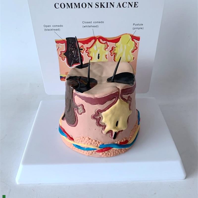 放大皮肤b结构解剖模型组织层次皮肤构造模型具微整形缝合美容教