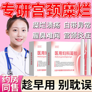 重度宫颈糜烂出血炎症白带多发黄有异味专用妇科凝胶中药房同售VQ