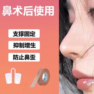 鼻术后支撑固定器防止鼻偏曲鼻支撑架抑制鼻增生鼻小柱偏曲矫正器