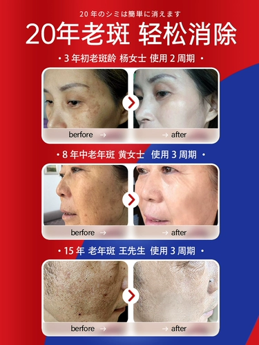 Идите, чтобы указать на мазь мазь для старой модной мази меланхолии.