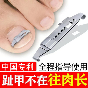 甲周矫正器指甲矫正嵌甲神器纠正脚趾甲贴片卷曲甲沟专用正甲扣炎