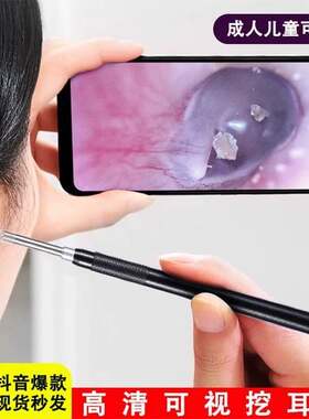 智能可视采耳仪器掏耳勺高清设备