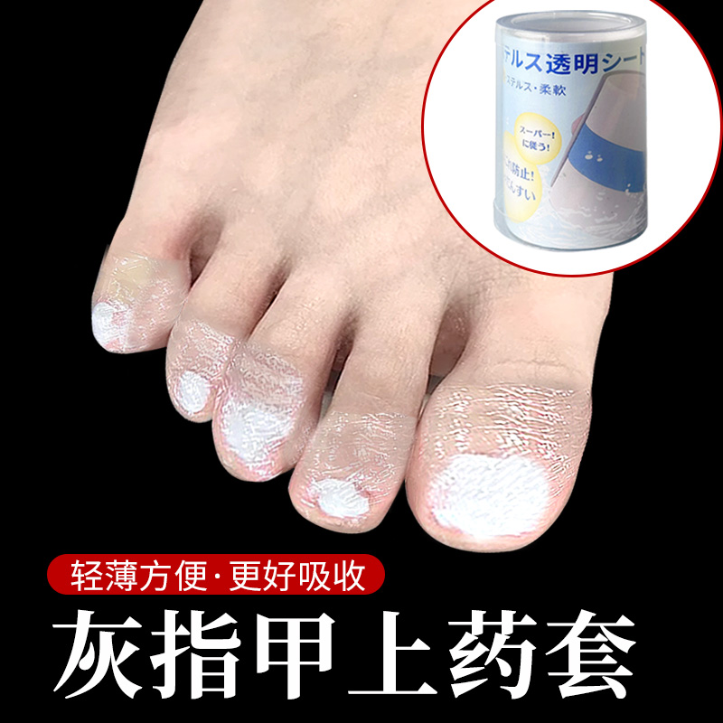 灰指甲上药套灰指甲脚趾手指保护套脚指抹药上药防护套保护脚趾