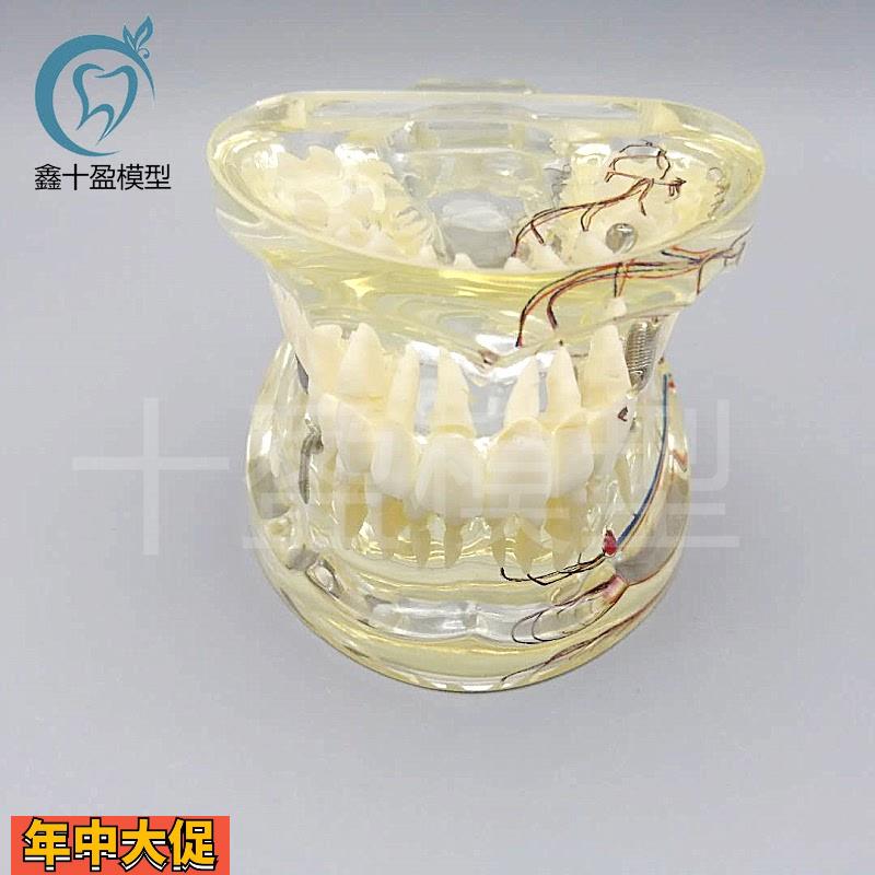 牙科水晶牙齿病理模型M4019-2成人透明病理牙模型带牙神经和嵌体