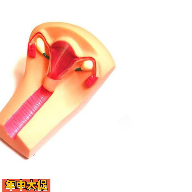 女性宫内避孕器及训练模型教学模具
