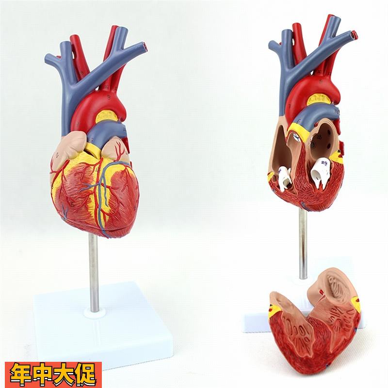 ENOVO颐诺人体心脏模型医学心血管内科心脏介入解剖教学冠状动脉