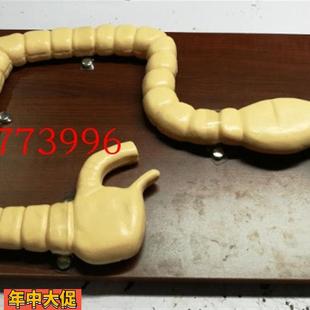 乙状结肠镜检查模型肠病变模型大肠肠道病变模型