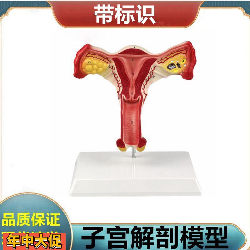 子宫解剖模型女生殖器解剖可拆卸盆底肌肛周肌肉泌尿道膀胱妇科