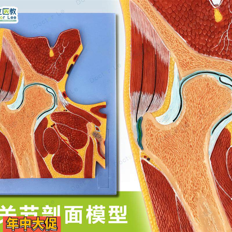 人体断层扫描髋关节切面浮雕髋关节断层解剖学模型ct