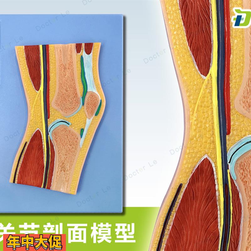 人体断层扫描膝盖切面浮雕膝关节断层解剖学模型ct运动解剖