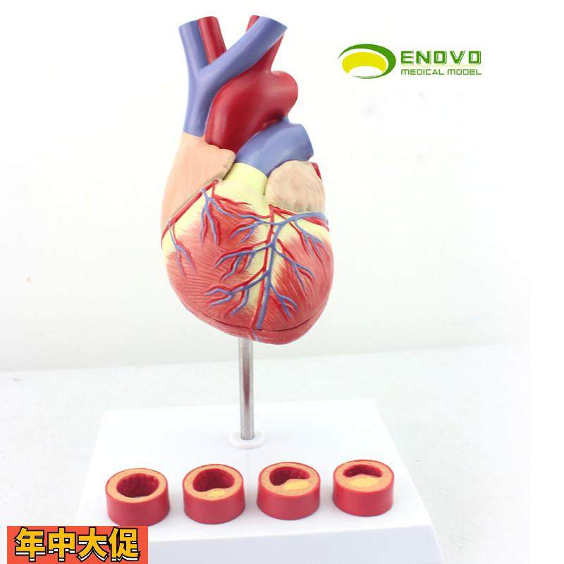 ENOVO颐诺1:1医学人体心脏模型冠状动脉血栓心内科教学动脉粥样,文具电教/文化用品/商务用品,教学标本/模型,淘宝优惠券,粉丝福利购,淘宝优惠卷