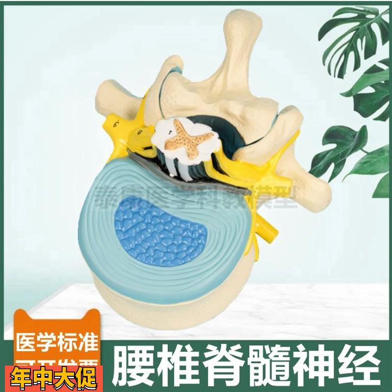 腰椎脊髓解剖模型脊神经根椎管临床麻醉教学神经节周围椎间盘人体