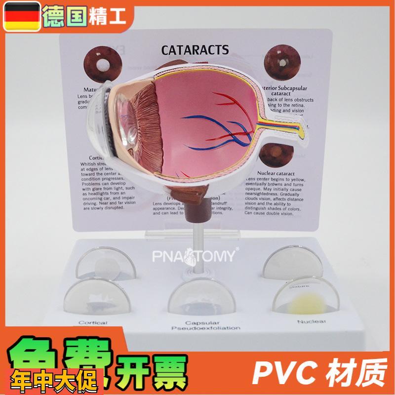 德国】眼球模型病理眼球演示教具眼科展示礼品人体器官解剖模型放