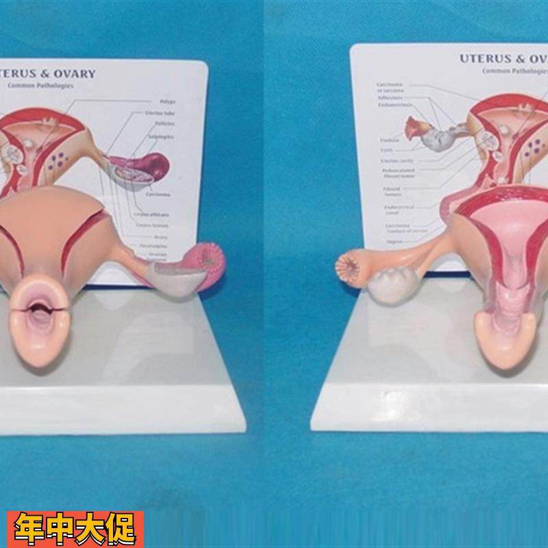 包邮子宫卵巢(健康)模型生殖器解剖计生医用教学讲解,玩具/童车/益智/积木/模型,其他模型玩具,淘宝优惠券,粉丝福利购,淘宝优惠卷