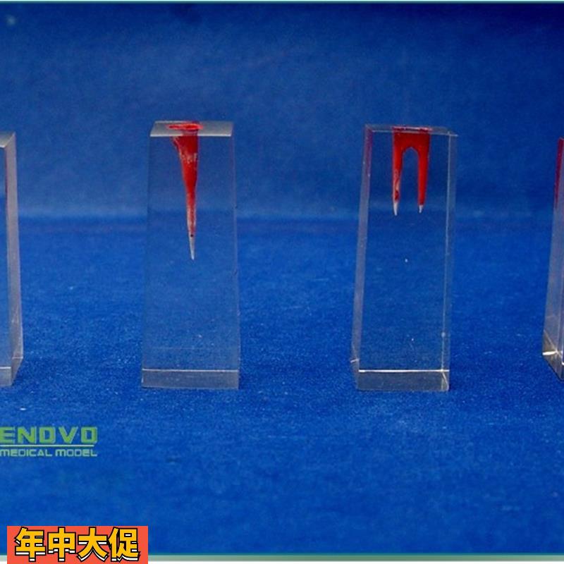颐诺正品口腔科实习用根管模型牙体牙髓学根管充填和窝洞制备