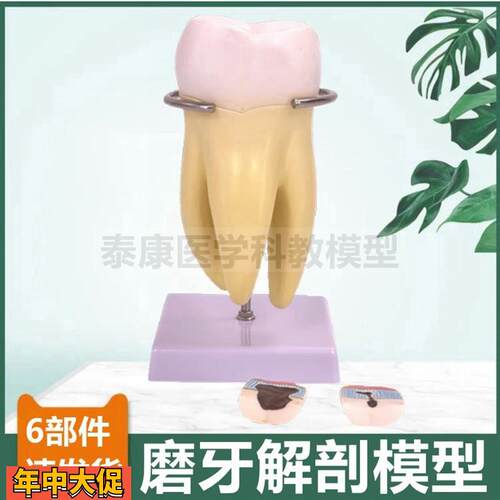 牙齿模型切牙尖牙磨牙拆卸口腔牙医牙科教学标本龋齿蛀牙发展过程