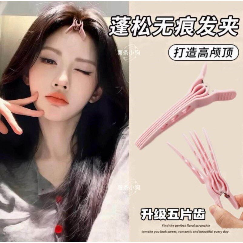 薯条小狗五片齿升级款高颅顶蓬松夹很好拿捏自然颅顶刘海发根蓬松