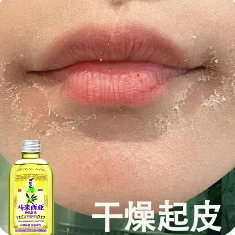 脸上起皮掉皮干皮脸起皮发痒嘴边干燥起皮干皮脸上脸干痒涂抹膏药