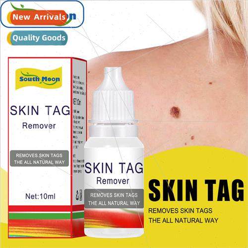 Wart Removal Wart Removal Wart Removal Wart Removal Wart Rem