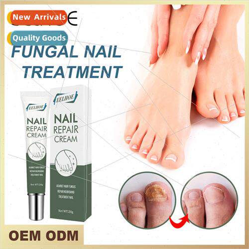 Gray Nail Repair Cream Quick Go Gray Nail Repair Nail Care O
