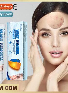 Wart Cream Skin Cleansing Hands and Feet Face Underarms Fles