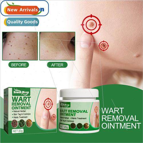 Wart Cream Skin Hand and Foot Removal Chicken Eye Flat Plant