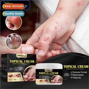 Hand and Foot Itch Relief Cream Amazing Skin Dry Itchy Itchy