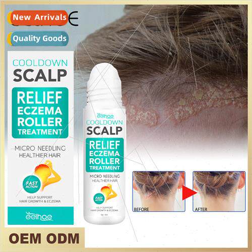 Scalp Care Roller Balls Deep Cleansing Repair Skin Moss Scal