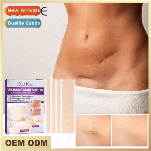 licone Scar Stickers Desalinate Scars Stch Marks Burns Cesar