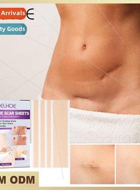 licone Scar Stickers Desalinate Scars Stch Marks Burns Cesar