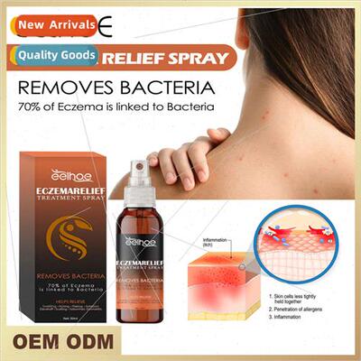 Skin Relief Spray Body Skin Care Psoriasis Redness Itching D