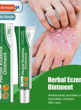 Skin Care Ointment Relieve Redness and Itchy Skin on Hands a