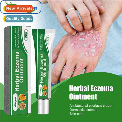 Skin Care Ointment Relieve Redness and Itchy Skin on Hands a