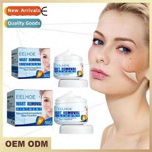 Wart Cream Wart Flat Chicken Eye Cleaning Wart Removal Eucal