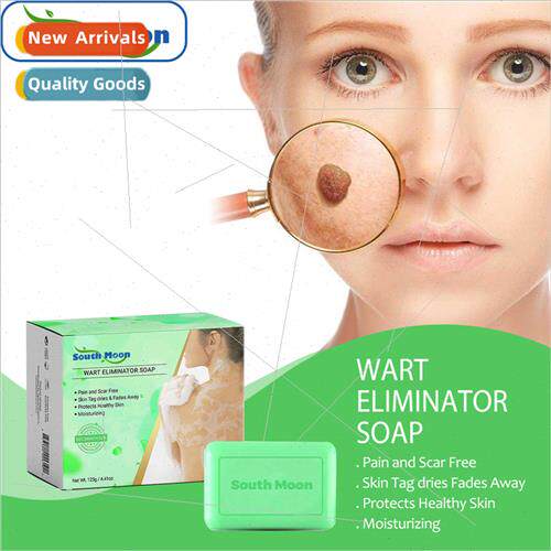 Warts Soap Face Neck Body Skin Cleansing Care Warts Soap