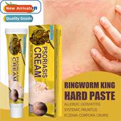 dermatophyte moss hand Skin foot Cream and mos Repair