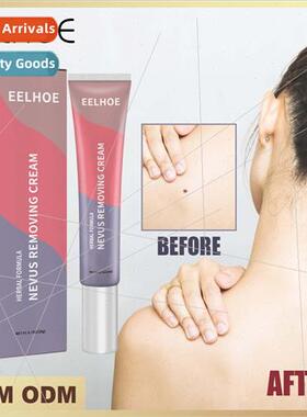 Mole Removal Ointment Body Skin Cleansing Mole ting Mole Rem