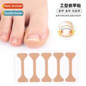 Nail Patch Corrective beam Stchi Curl Ortho Groove
