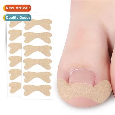 Glue-free corrective nail stickers to improve ingrown toes n