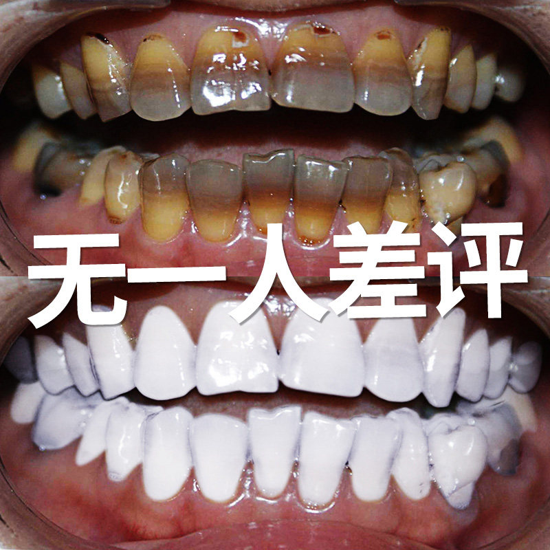 洗牙粉牙齿洁牙去黄神器黄牙结石去烟渍牙垢牙菌斑口臭牙斑净2发3