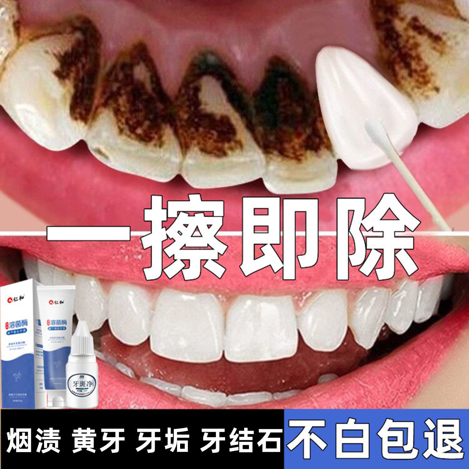 强力去烟渍牙膏去黄去口臭美白除茶垢牙齿结石溶解神器男女士专用