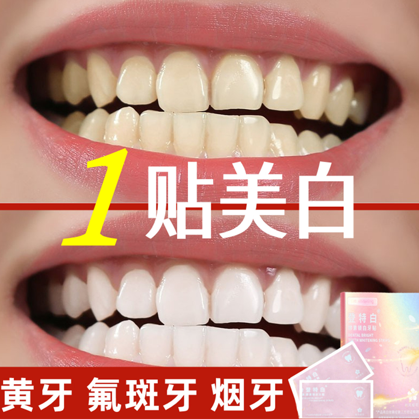 牙贴美白去黄洁白牙齿贴片速效亮白去除氟斑牙四环素强效变白神器