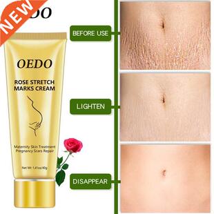 Rose Removes Stretch Mark Cream To Remove Postpartum Obesity