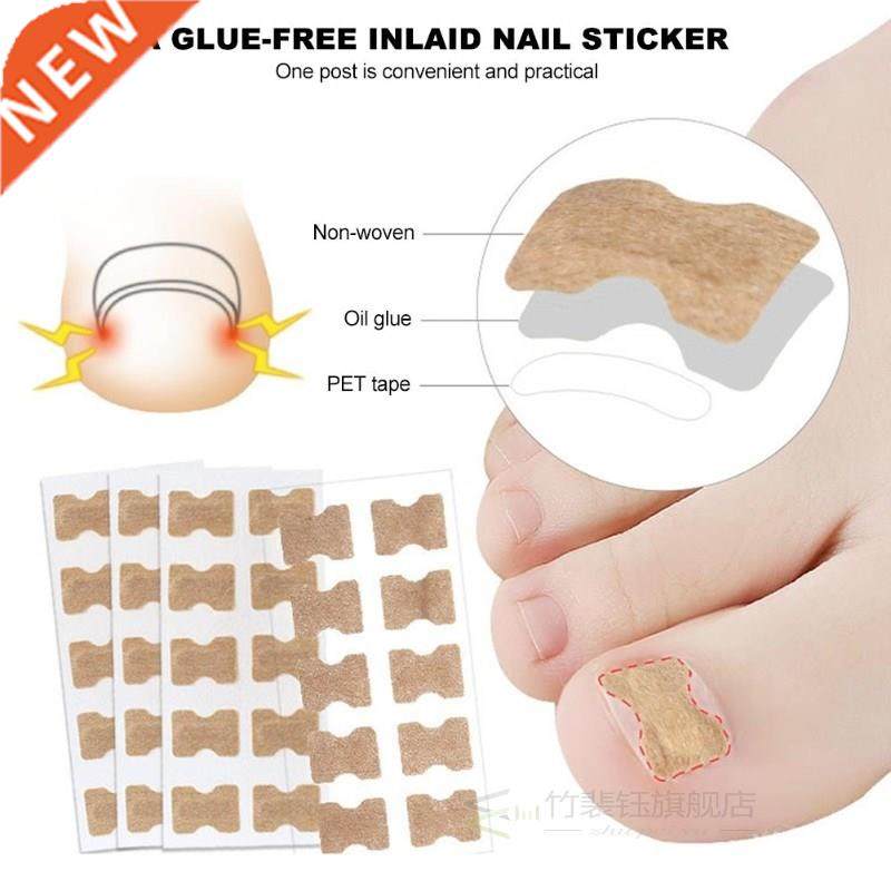 Ingrown Toenail Sticker Nail-Corrector Foot-Care Glue