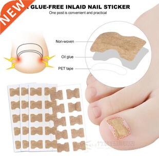 Ingrown Toenail Sticker Nail-Corrector Foot-Care Glue